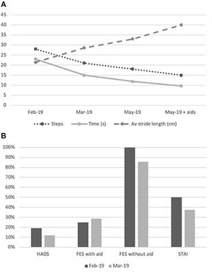 Case Report: Acute Onset Fear of Falling and Treatment With “Cognitive Physical Therapy”